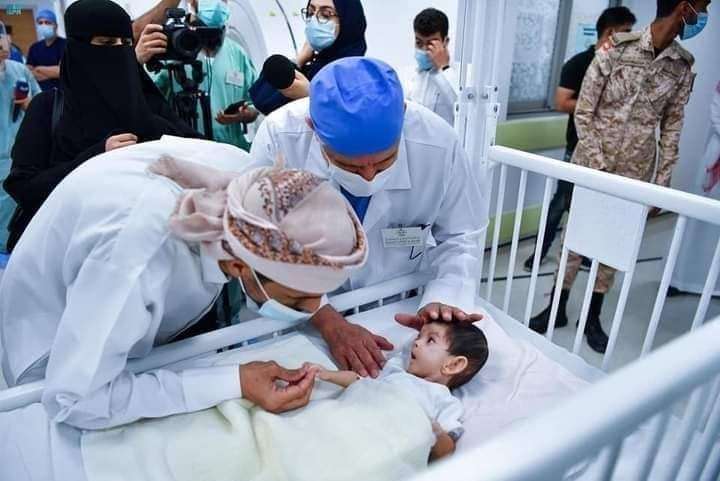 الدكتور الربيعة يعلن نجاح عملية فصل التوأم الطفيلي اليمني(نسخة إضافية )