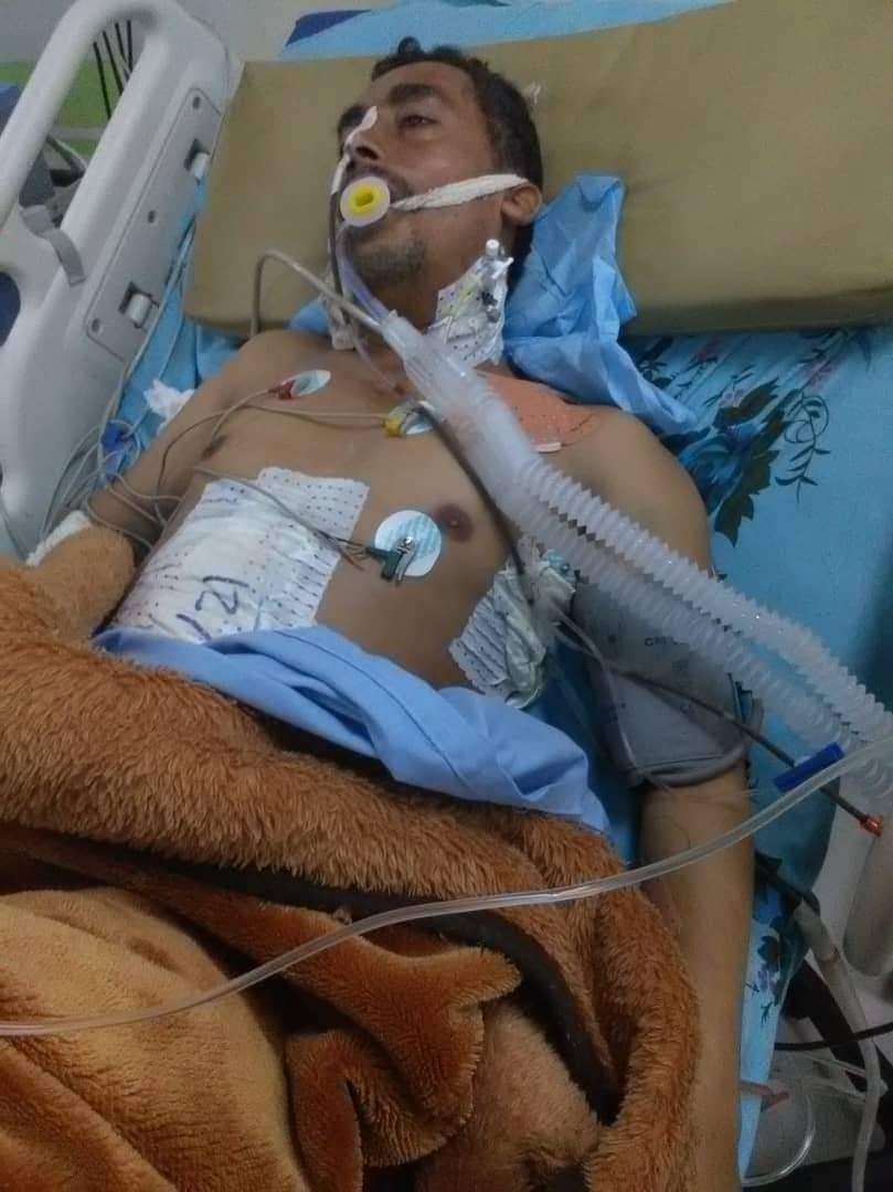 تدهور الحالة الصحية لمواطن عقب إصابته برصاص راجع بإب