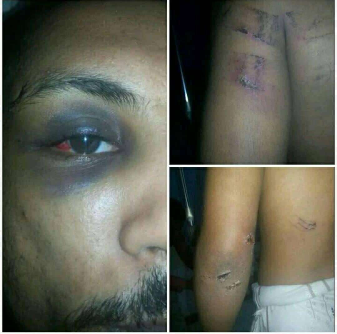 تعرض قيادي بالحراك الجنوبي لتعذيب وحشي بعدن وسط انباء عن تصفيته تعرض قيادي بالحراك الجنوبي لتعذيب وحشي بعدن وسط انباء عن تصفيته
