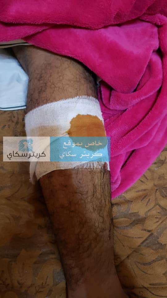 بالصور.. حرس الحدود العماني يعتدي على الحريزي وشخص اخر بالصور.. حرس الحدود العماني يعتدي على الحريزي وشخص اخر