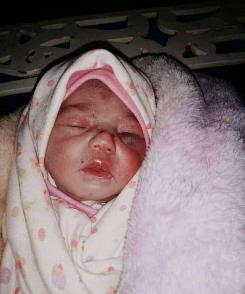 عقب تتداول صورها .. تعرف على قصة الطفلة التي أثارت العاصمة صنعاء(صورة)