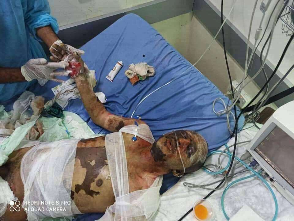 مواطن يقدم على إحراق نفسه في تعز والسبب خلاف على إسطوانة غاز مواطن يقدم على إحراق نفسه في تعز والسبب خلاف على إسطوانة غاز