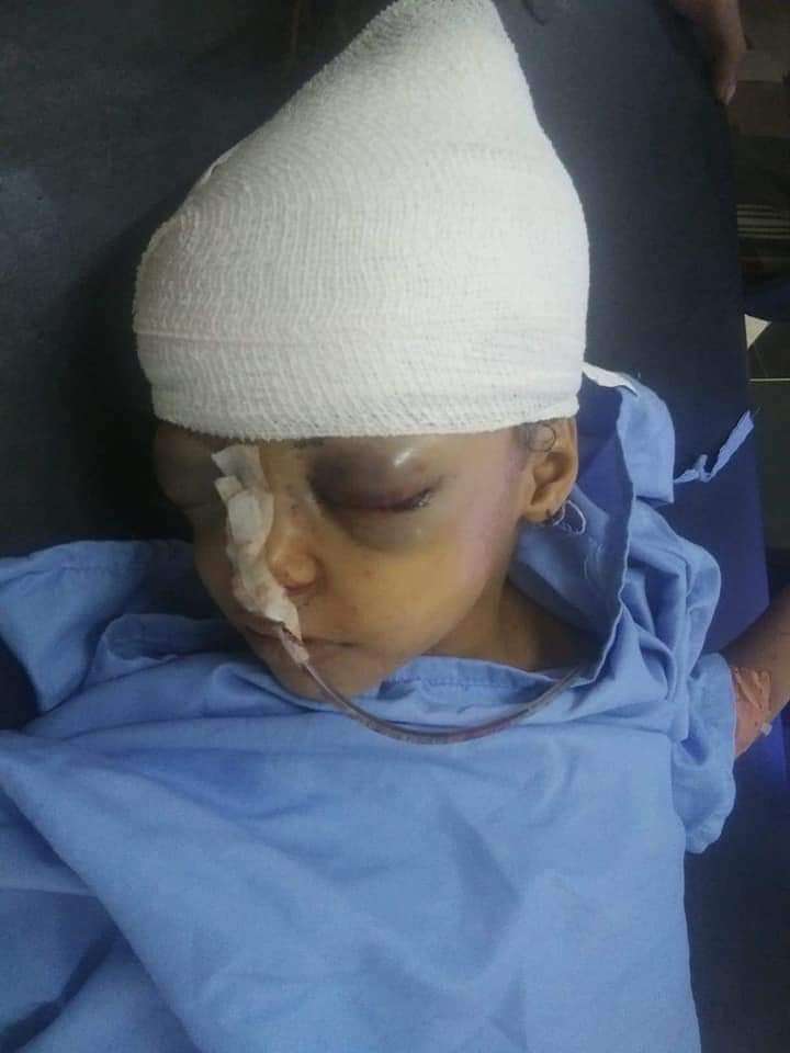 إصابة طفل في إب ومصدر يفصح عن السبب(صورة)