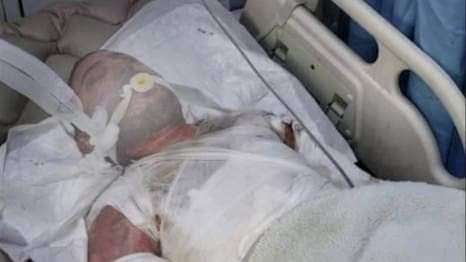 مجهولون يقومون بإحراق مواطن أمام الملأ في إب(صور)