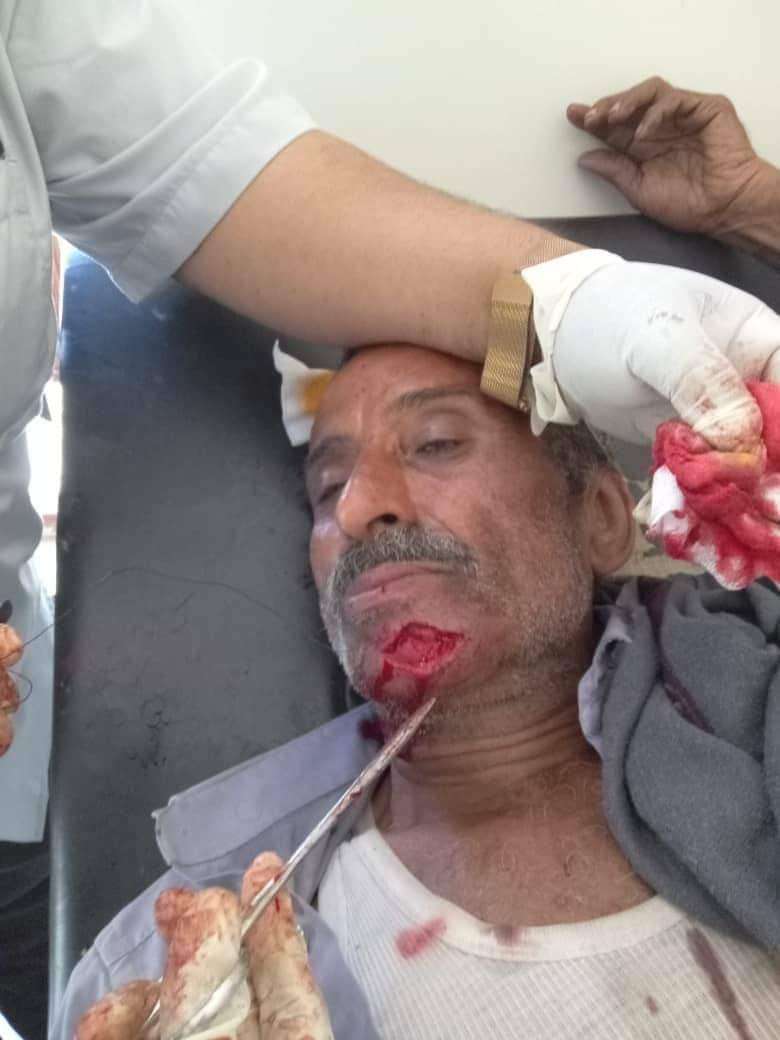 بطريقة بشعة .. مواطن يتعرض للاعتداء من قبل قائد قوات الامن الخاص بتعز(صورة)