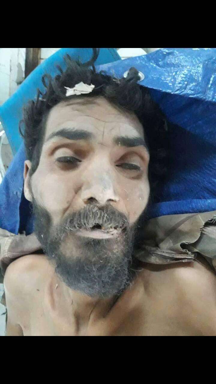 وفاة مواطن مجهول الهوية جراء حادث مروري في يريم (صورة)