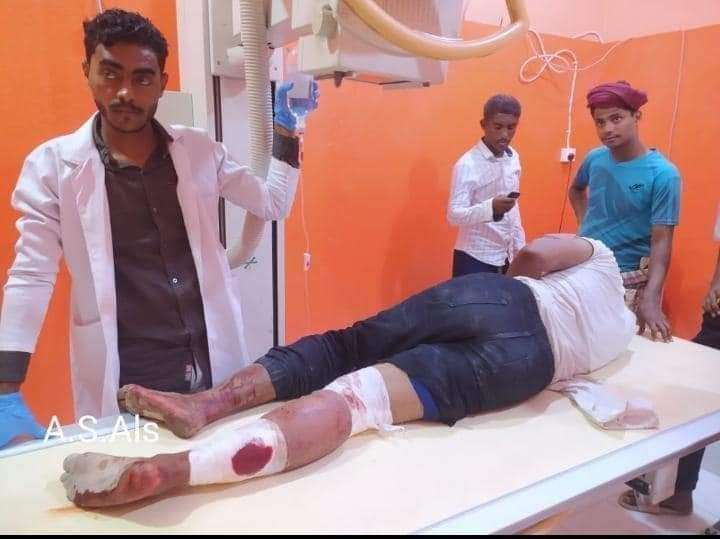 عاجل :سقوط اول جريح بانتفاضة حضرموت برصاص قوات الامن