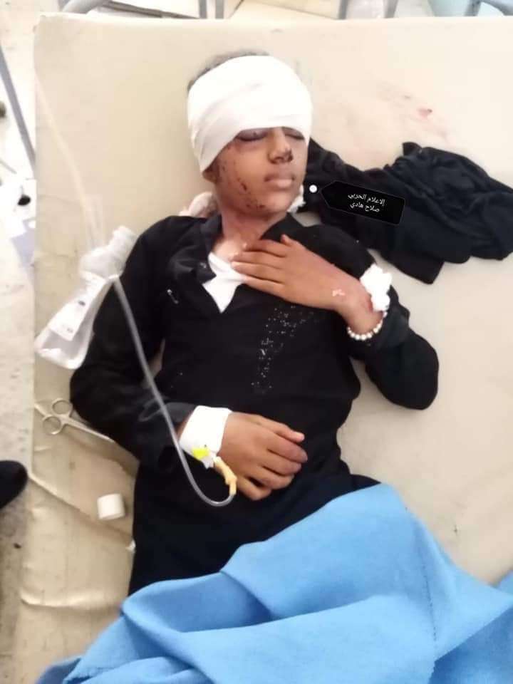 إصابة طفلة برصاص قناص بتعز