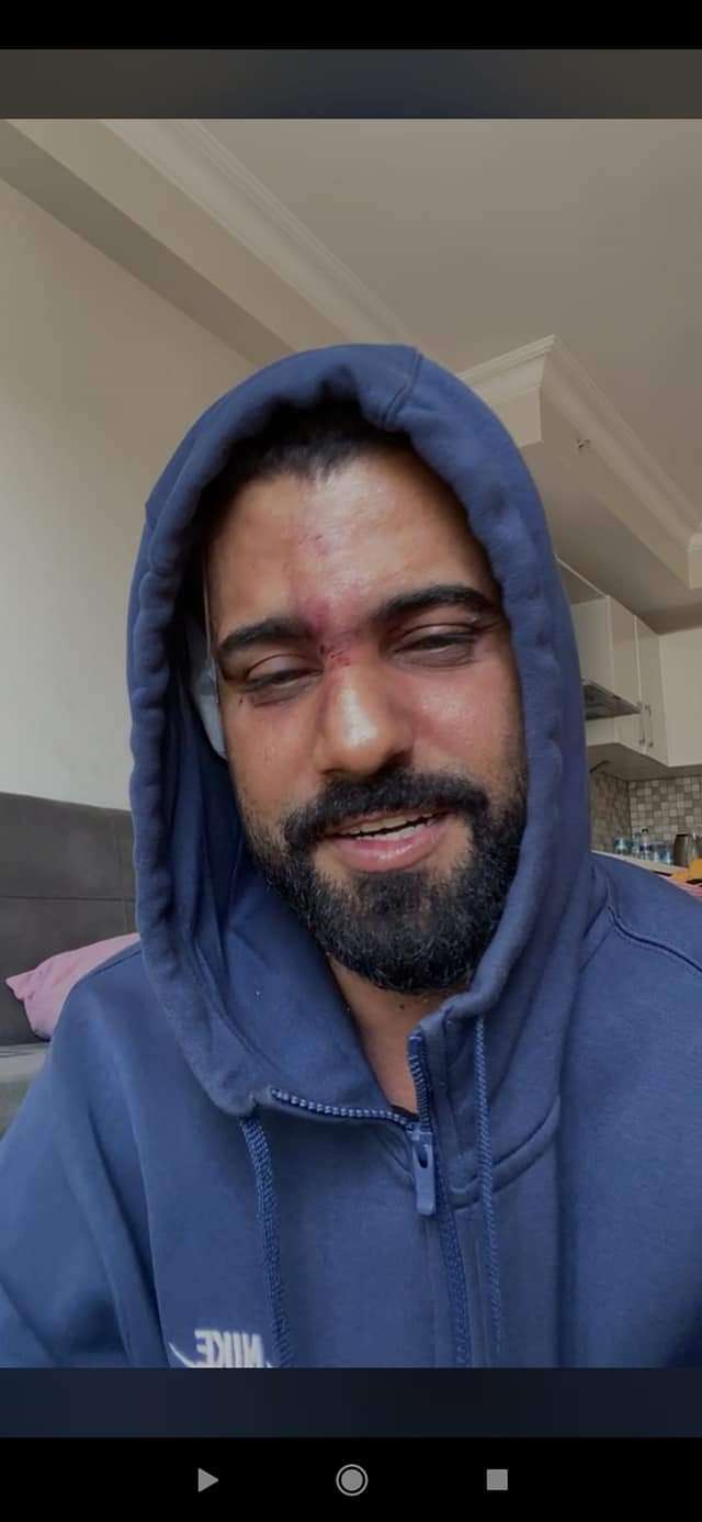 تعرض للاغماء.. بالفيديوعدنان الخضر يكشف تفاصيل تعرضه للاعتداء بتركيا تعرض للاغماء.. بالفيديوعدنان الخضر يكشف تفاصيل تعرضه للاعتداء بتركيا