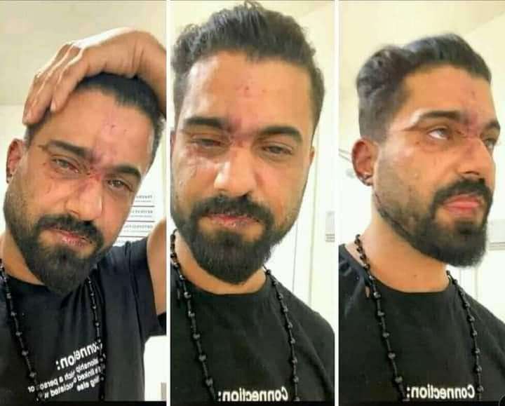 يسران المقطري يوجه رسالة للفنان العدني عدنان الخضر عقب تعرضه للاعتداء من قبل الشرطة التركية
