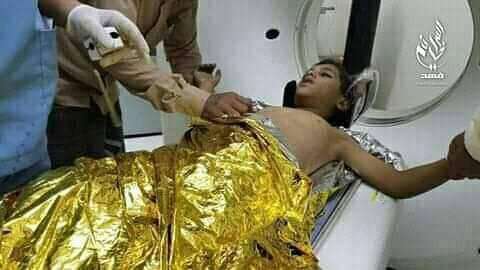 وفاة طفل متاثرا باصابته بقصف في تعز