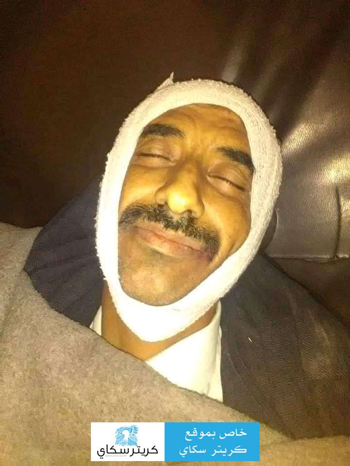 شاهد اول صورة لقائد الحزام الامني في قعطبة عقب اغتياله