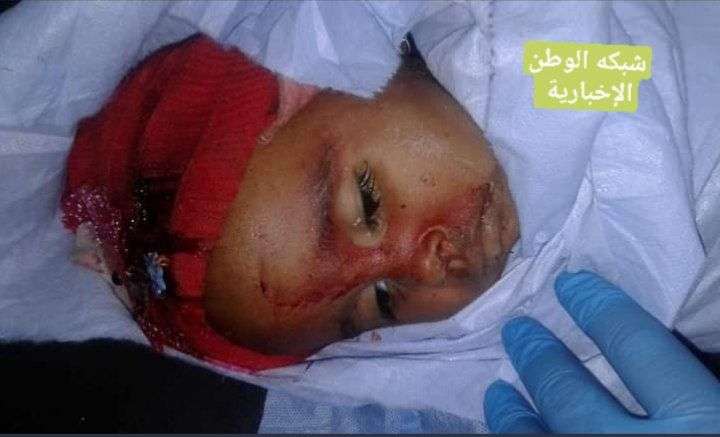 صورة لطفلة عمرها 7 أشهر تثير تعاطف على مواقع التواصل الاجتماعي