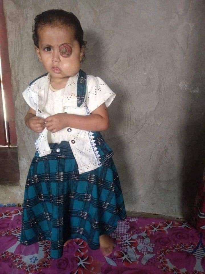 مناشدات لإنقاذ الطفلة زينب من ورم سرطاني