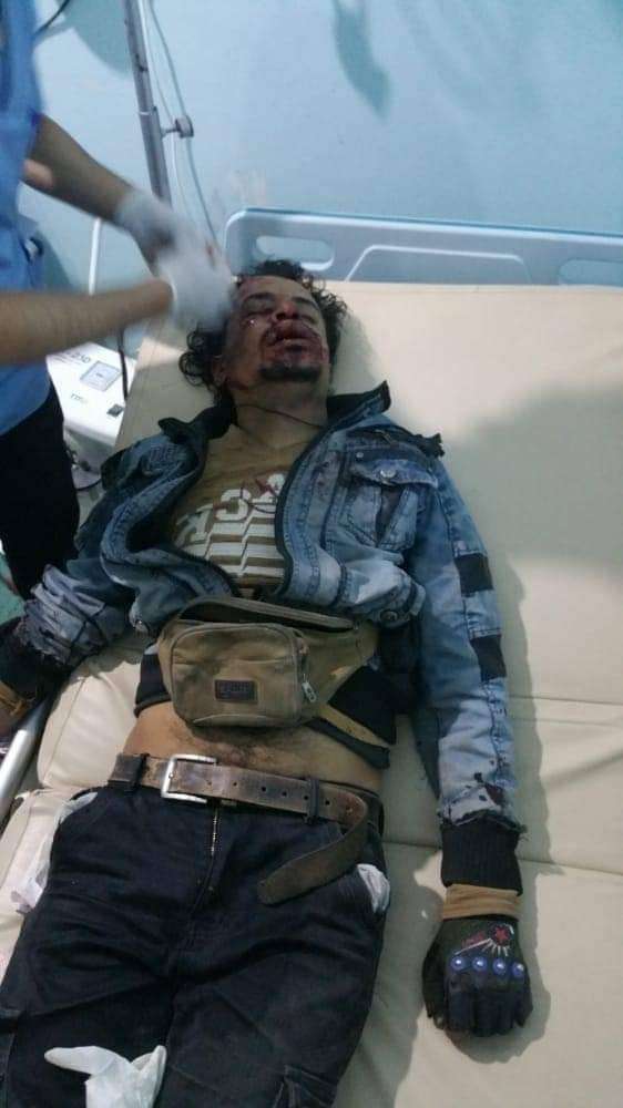 عاجل : العثور على جثة مواطن في اب (صورة) عاجل : العثور على جثة مواطن في اب (صورة)