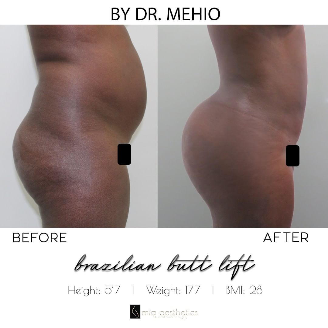 The brand's vision is based on the idea that being beautiful and saving money are two realities that can exist simultaneously. Dr Mehio Plastic Surgeon Mia Aesthetics Cosmetic Surgery