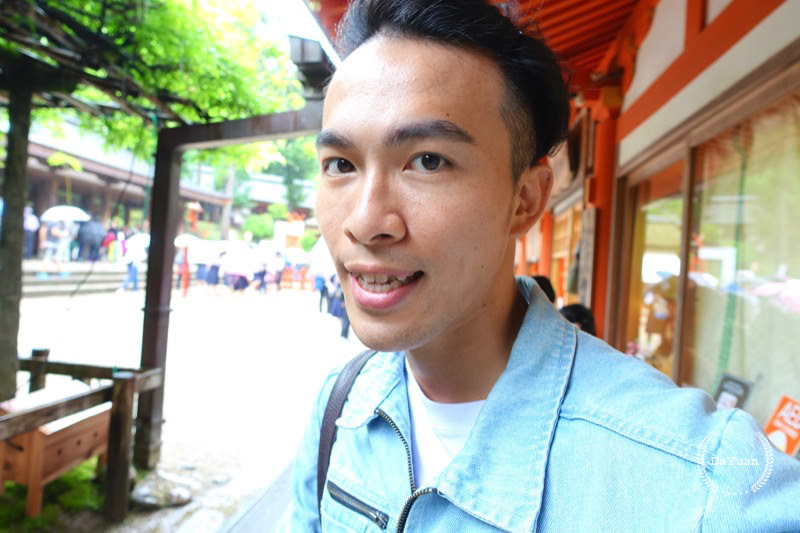 牙齒矯正｜SOV舒服美 關於隱形牙套，你可能想知道的事（2）