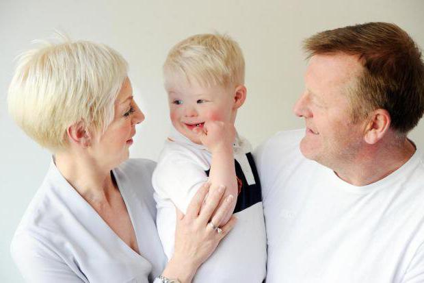 ما هي اسباب متلازمة داون؟. Ø·ÙÙ Ø£Ø³ÙÙ ÙØ§Ø°Ø§ ÙØ¹ÙÙ Ø°ÙÙ Ø¹ÙØ§ÙØ§Øª ÙØ£Ø¹Ø±Ø§Ø¶ ÙØªÙØ§Ø²ÙØ© Ø¯Ø§ÙÙ