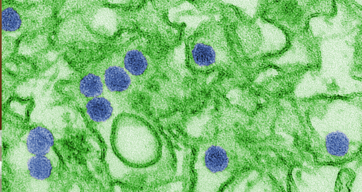 Explosive Diarrhea Outbreak: How Cyclospora Differs From Norovirus and E. coli