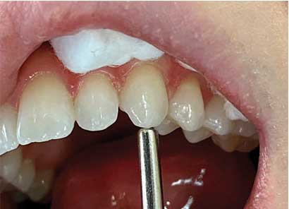Dentistry Test  . From The Jaw To The Cranium.