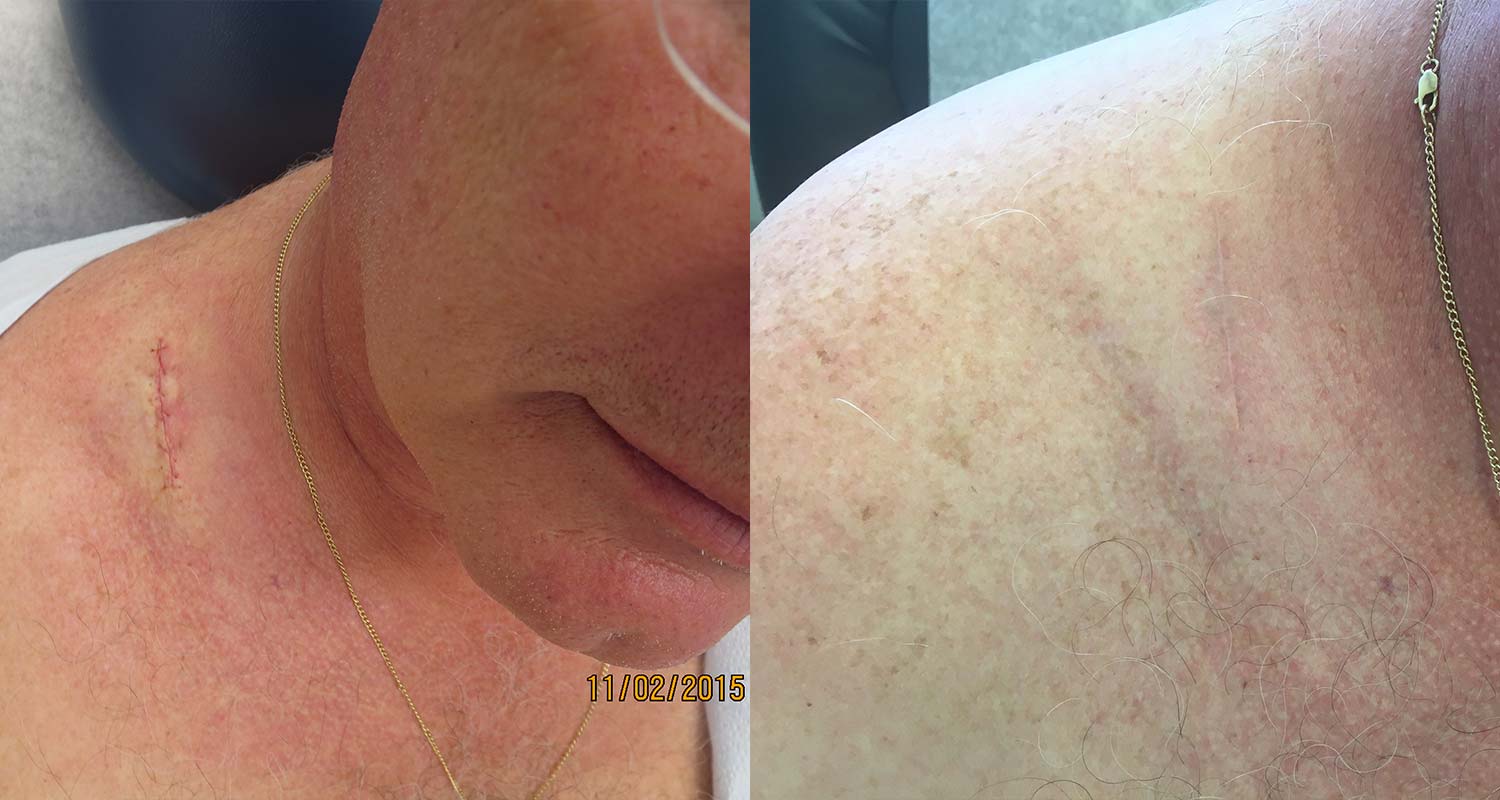 Surgery — DermAssociates