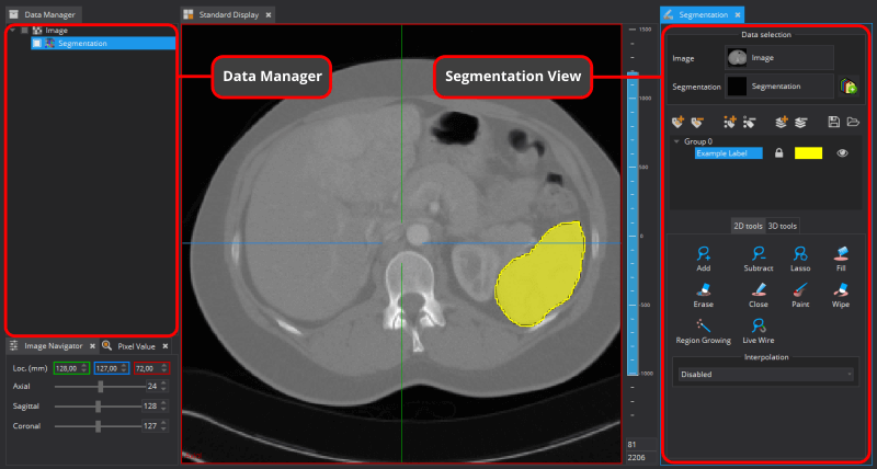 Medical Imaging Interaction Toolkit The Segmentation View