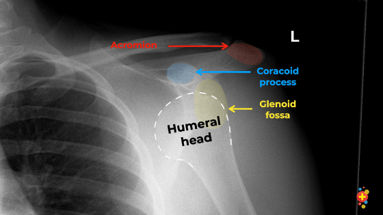 Shoulder X Ray Interpretation Don T Forget The Bubbles