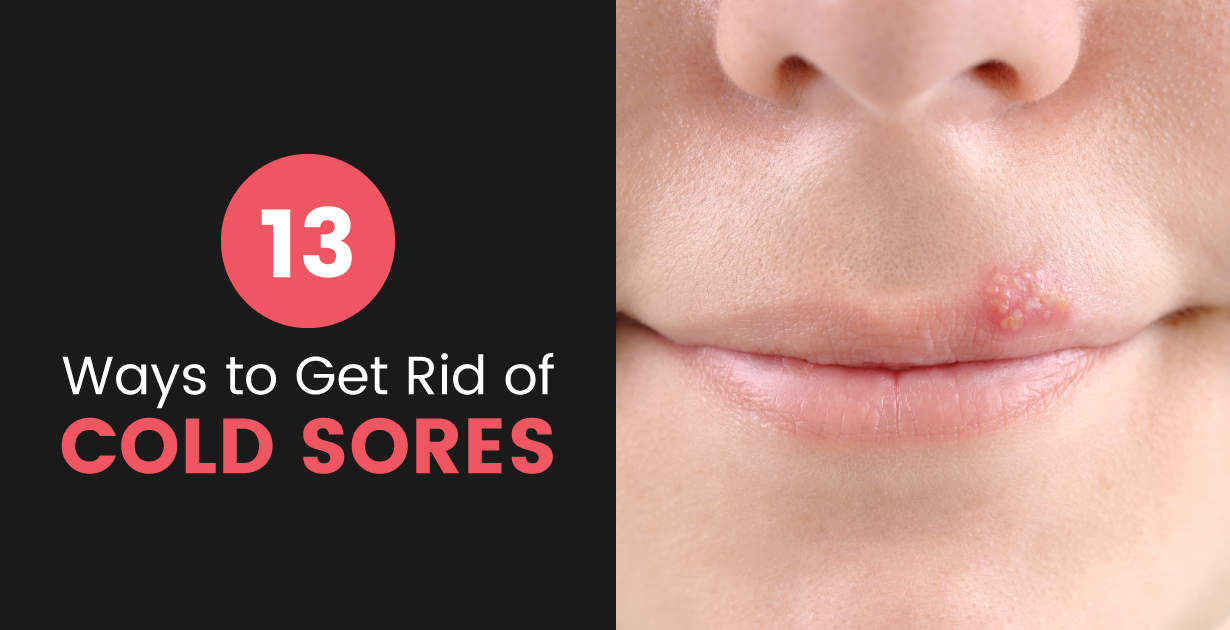 For some infections that cause sore throats (like strep throat), you’ll need to see a doctor and take antib. Cold Sores How To Get Rid Of Cold Sores Naturally Dr Axe