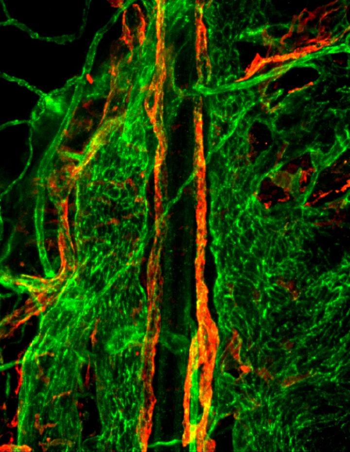 Cancers of the brain and nervous system are the most common type of childhood cancer. Unraveling The Link Between Brain And Lymphat Eurekalert