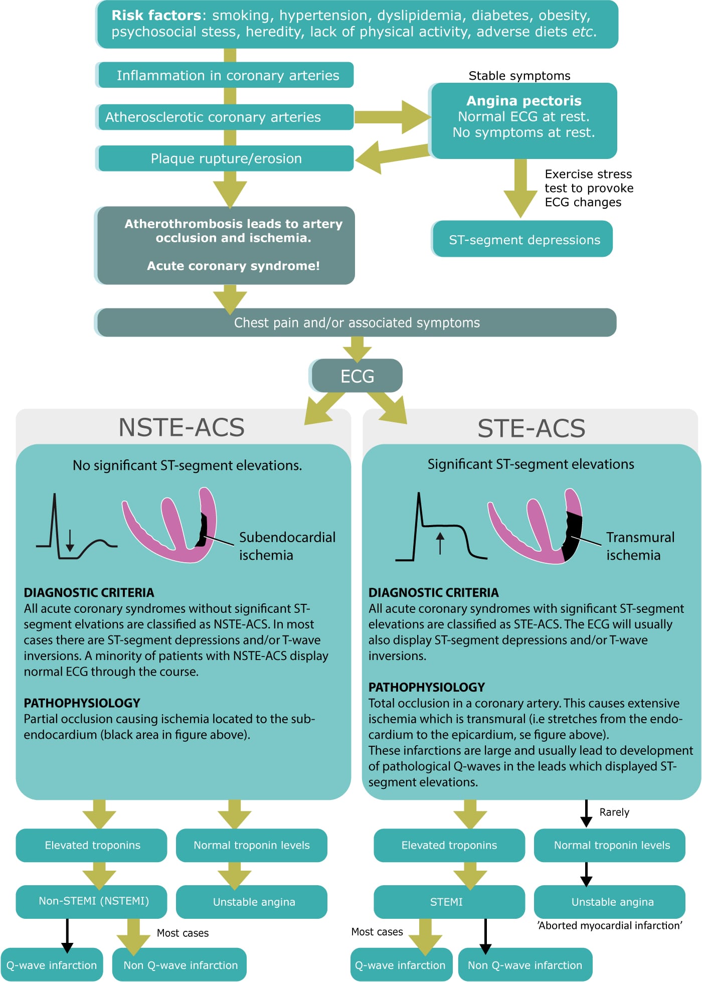 In the setting of normal ecg, troponin, and inflammatory markers, myocarditis or pericarditis are unlikely. Figure 1. Classification of coronary heart disease
