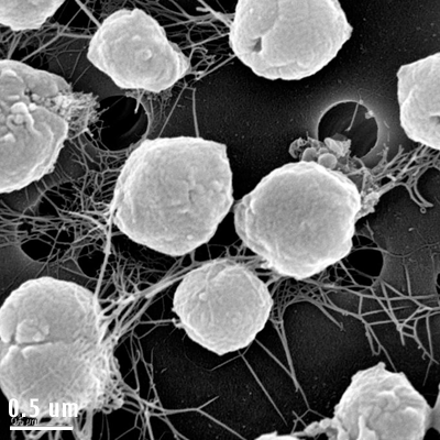 Archaebacteria (Archaea) : Pengertian, Ciri-ciri, Struktur Sel, Contoh:blog  info