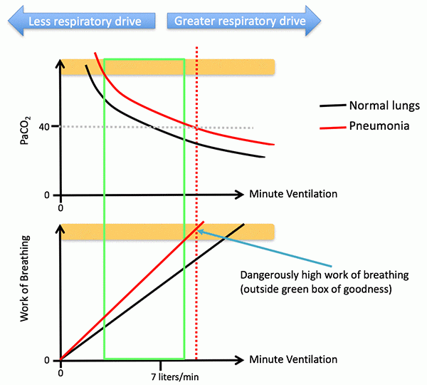 Pulmcrit Optimizing The Respiratory Drive To Avoid Failure Pulmcrit Optimizing The Respiratory Drive To Avoid Failure