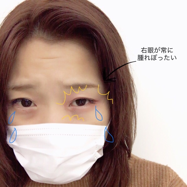 冬対策はお早めに 目の疲れにはあのアイテムを Endlink