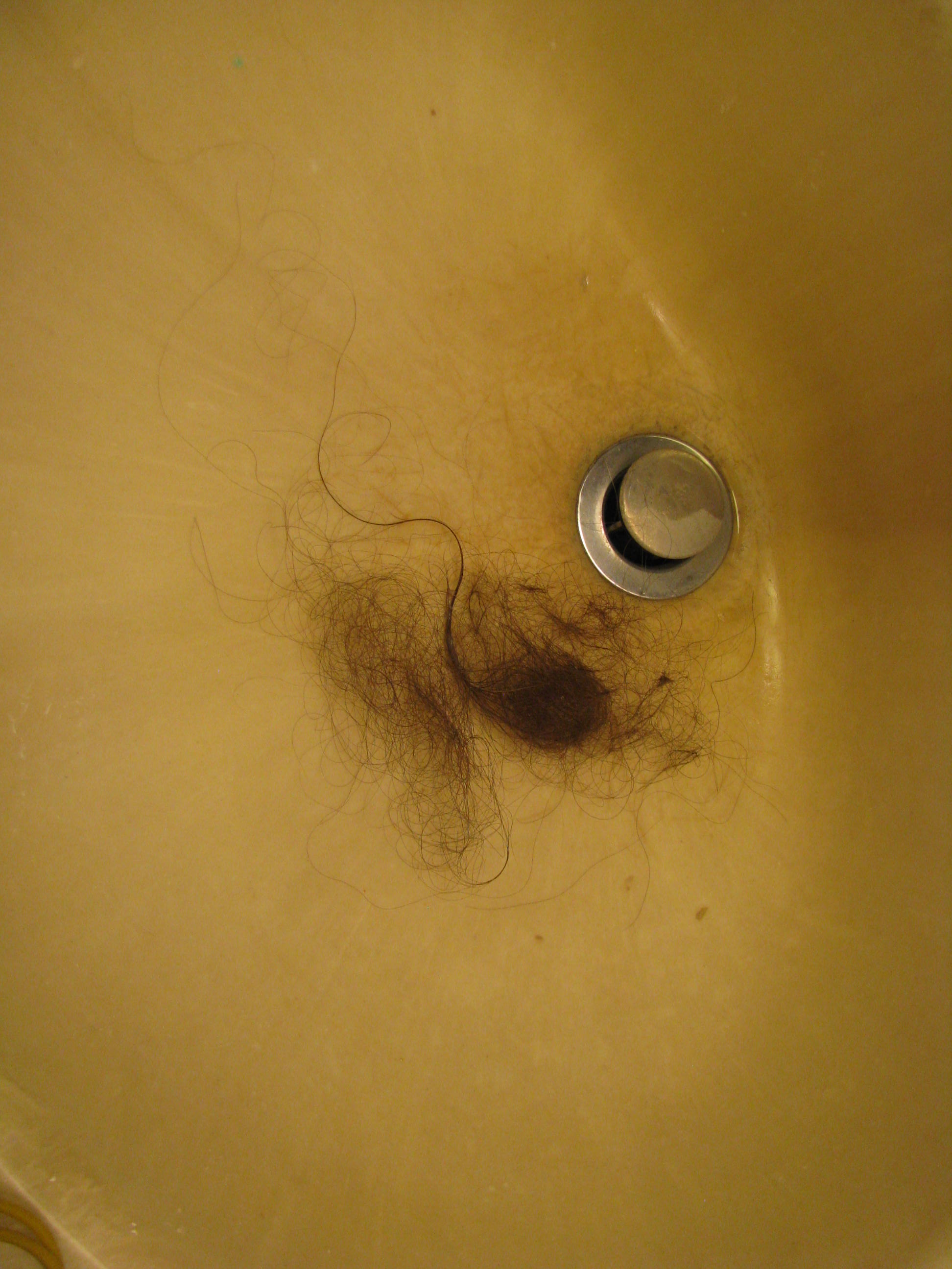 The emotional fallout from a bad hair day is all too real. postpartum hair loss Archives - Everythings Coming Up Green