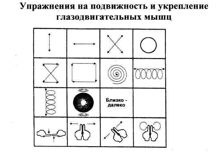 Упражнения для глаз при косоглазии. Как избавиться от косоглазия в домашних условиях
