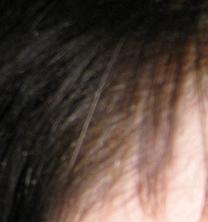 one white hair on a background of black hair
