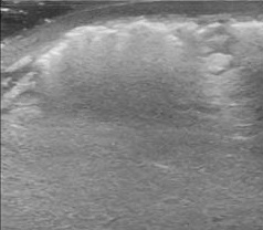 Soft Tissue 3