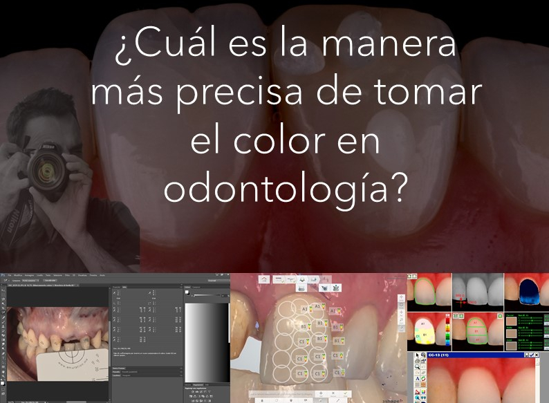 Cual Es La Manera Mas Precisa De Tomar El Color En Odontologia
