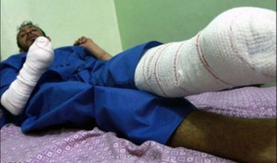 Amputated man (Credit: Iran Human Rights)