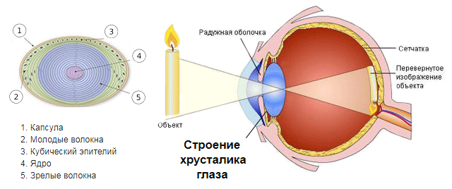 Лечение помутнения хрусталика глаза. Вам поставили диагноз катаракта глаза? Что это такое и как жить дальше Катаракта симптомы лечение профилактика