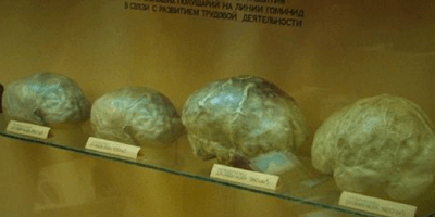 Anatomical Models Global Brain Museum