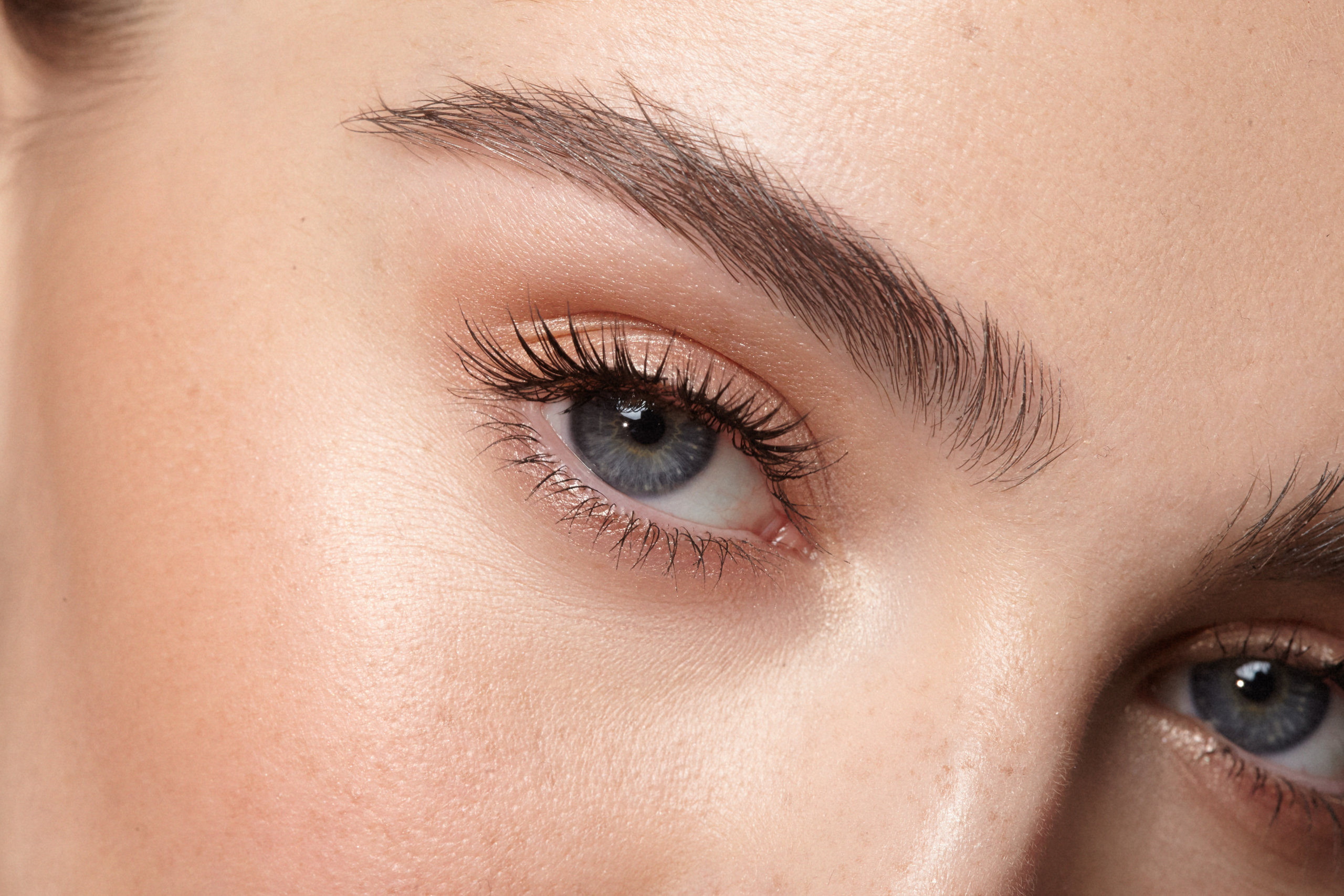 'Forever Tired' Eyes,forever tired,eyelid,eye fatigue