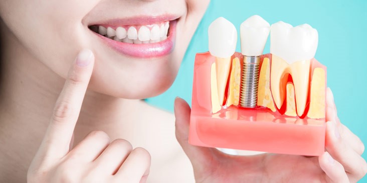 Bakteri yang menyebabkan peradangan di mulut hingga menimbulkan penyakit gusi dapat membuat gigi berdarah. Kenali Kenapa Gusi Berdarah Bagaimana Cara Mengatasi Dan Mencegahnya Happy Teeth Dental Care