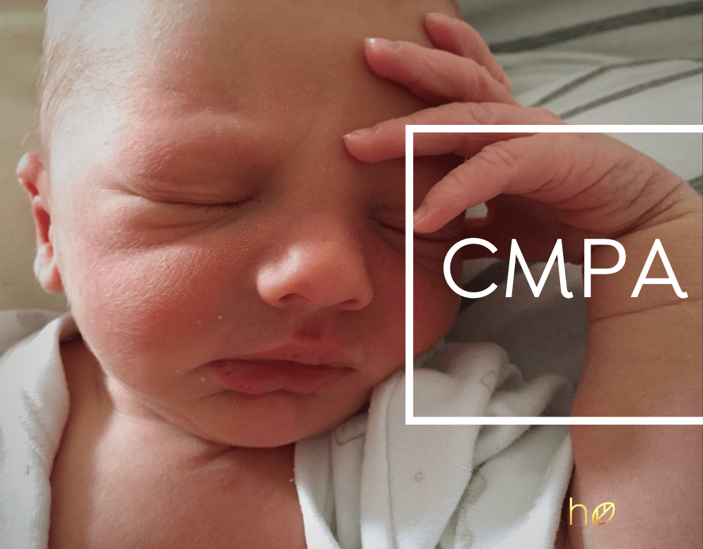 Refux and Cow's Milk Protein Allergy Healthy Eating Doctor