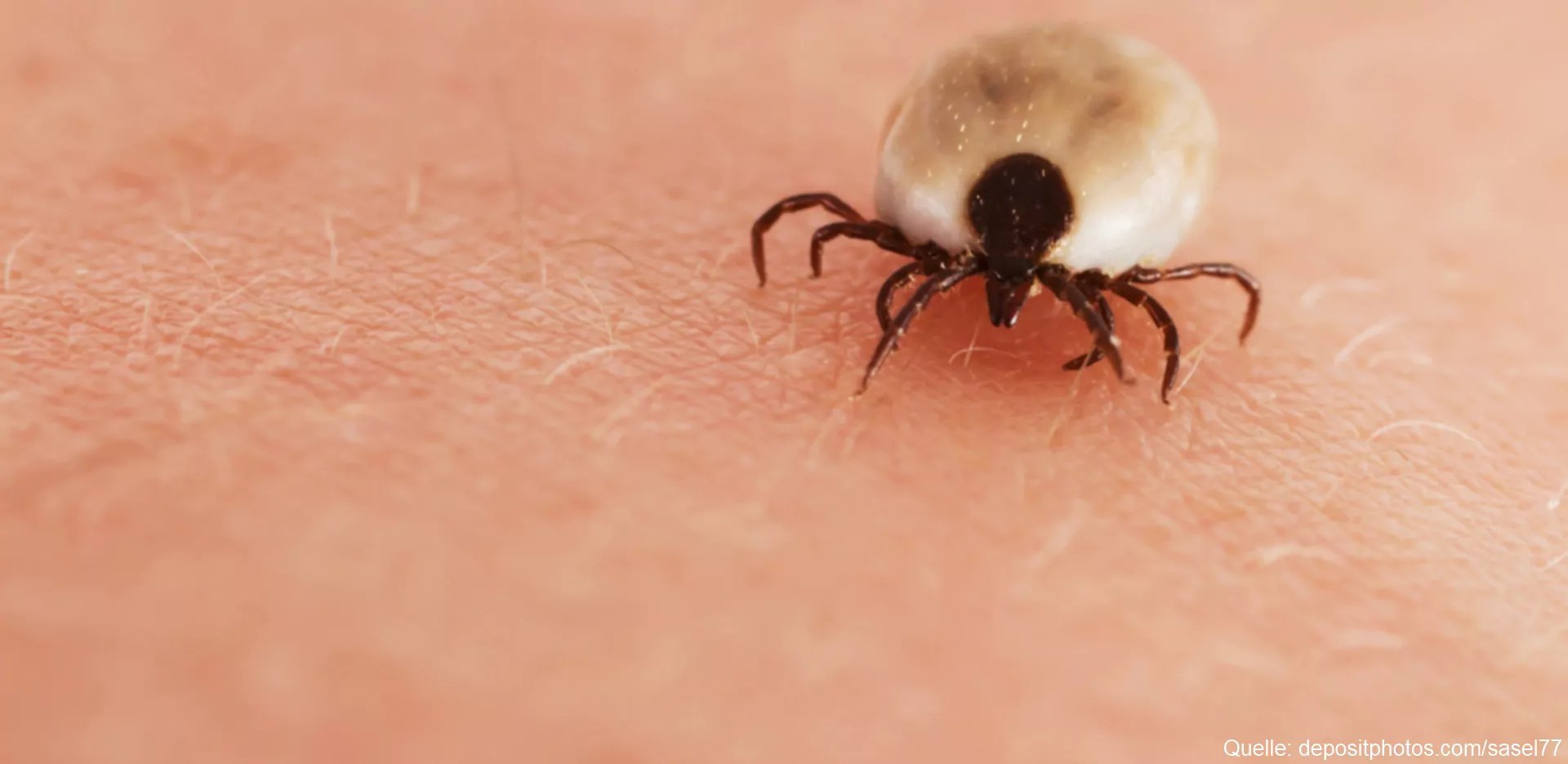 06.12.2021 · typische anzeichen einer schwangerschaft sind: FSME: GefÃ¤hrliche Erkrankung durch Zeckenbiss