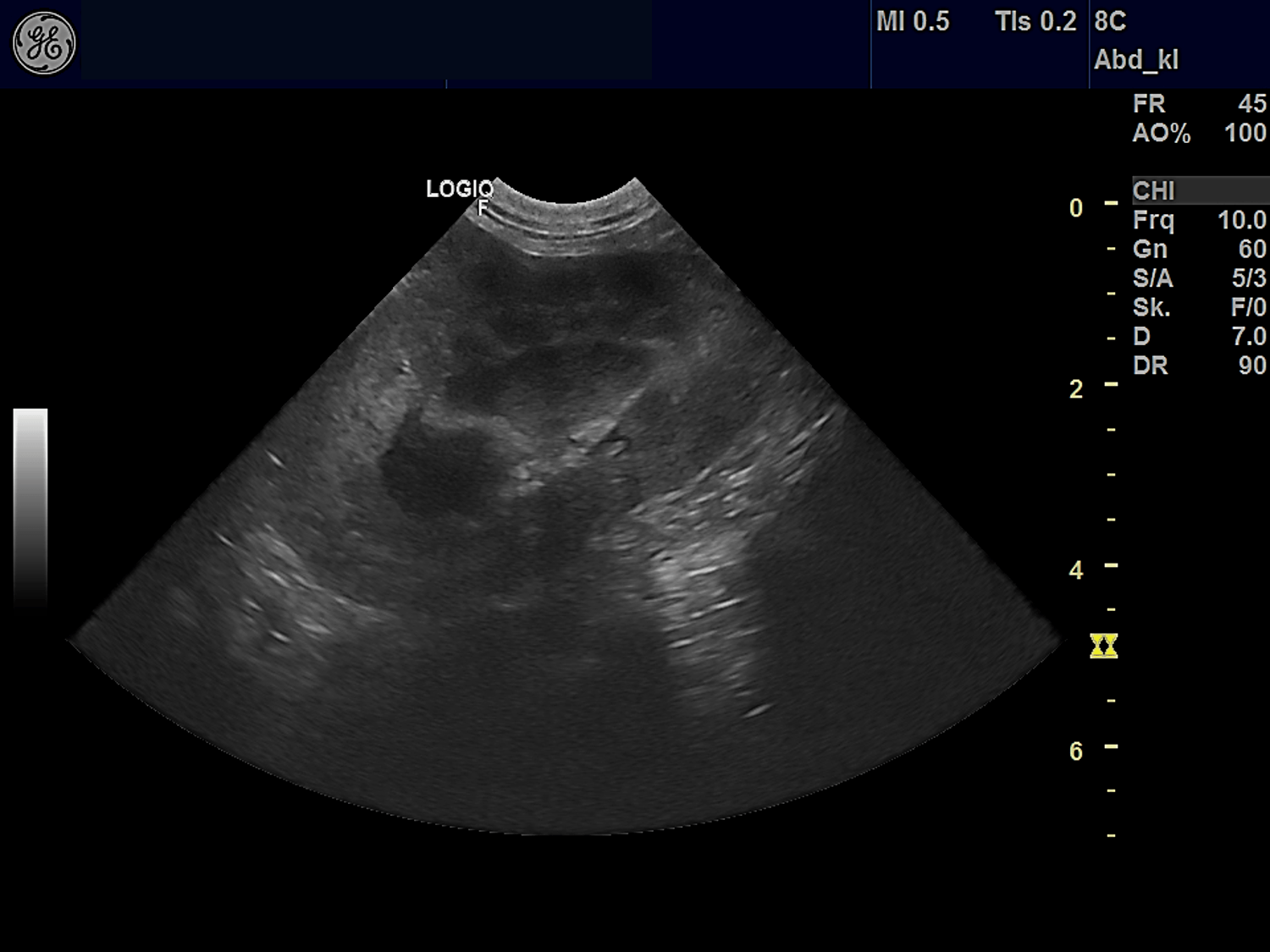 Wie sie einen dachs im garten vertreiben und woran sie ihn erkennen, lesen sie hier. Chronische Niereninsuffizienz beim Hundesenior - "Wenn