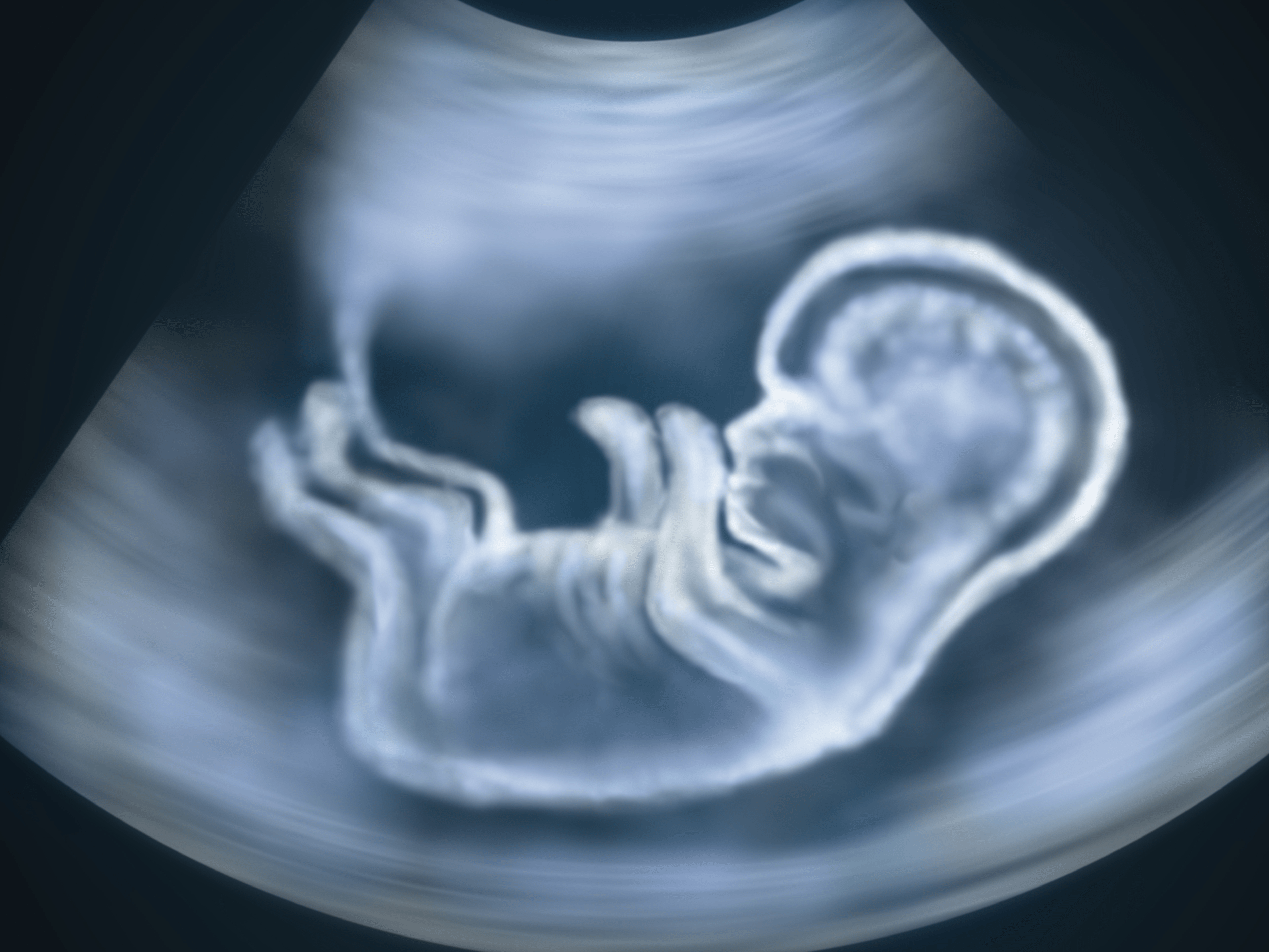 Find a sonogram imaging near you today. How Many Ultrasounds During Pregnancy Are Normal And What They Re For