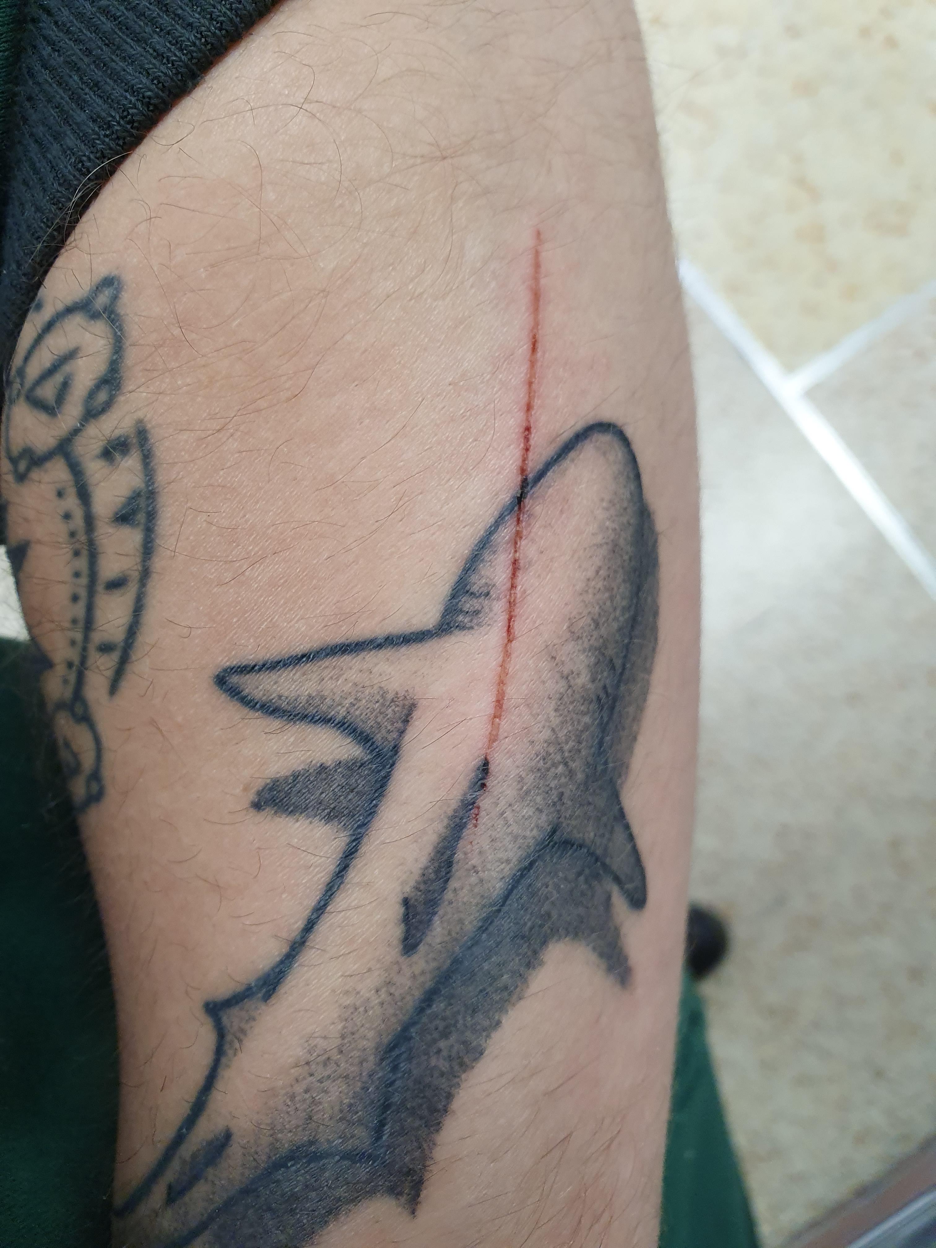 This Cut On My Arm Makes My Shark Tattoo Look Like It Has A Laser Beam Attached : R/Mildlyinteresting 4032_x_3024_jpg