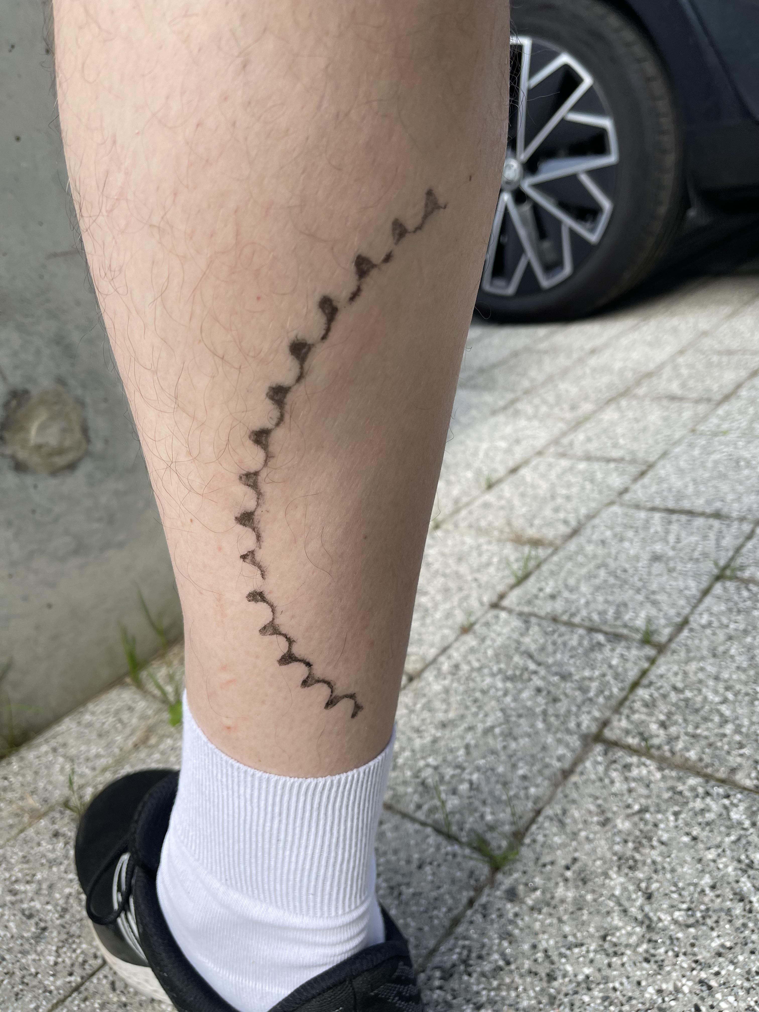 Bike Sprocket Made A Nice Mark On My Calf : R/Mildlyinteresting 4032_x_3024_jpg