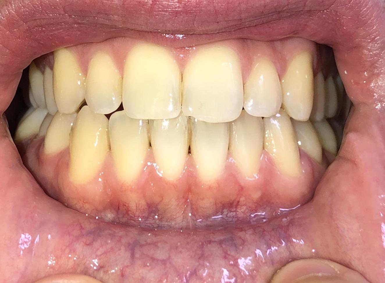 Dentist Vs Dental Hygienist Reddit  . Submitted 5 Months Ago By Mrsvl.
